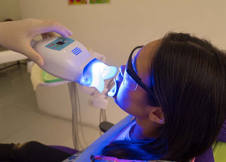 Laser Teeth Whitening Procedure