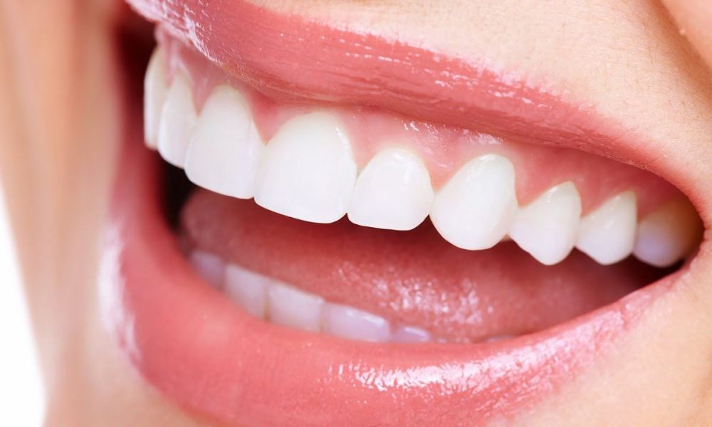 white-straight-teeth-fi13865104x2133_orig